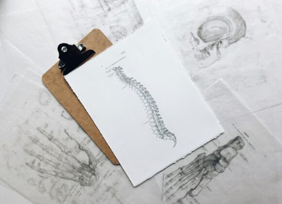 Jak skutecznie radzić sobie z przepukliną dysku: porady i terapie brown and black clipboard with white spinal cord print manual