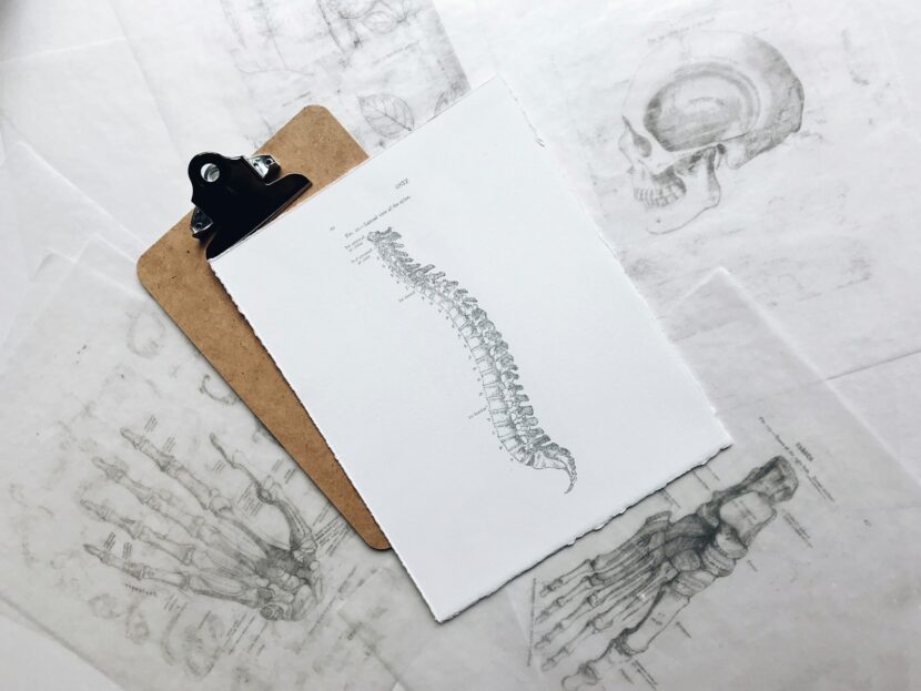 Jak skutecznie radzić sobie z przepukliną dysku: porady i terapie brown and black clipboard with white spinal cord print manual